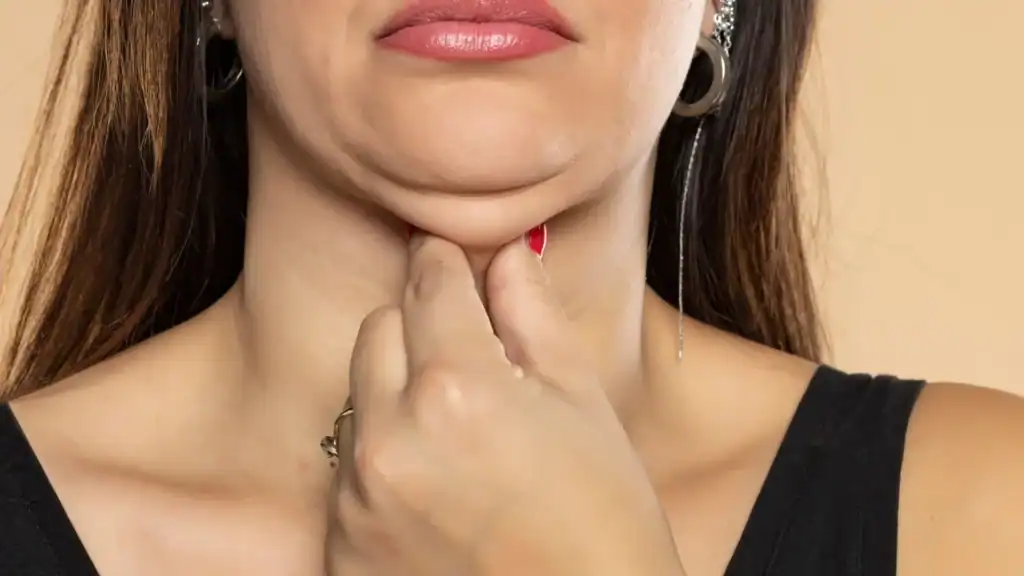 An image of a woman with double chin, sad, worried : Non Surgical Double Chin Removal Treatment in Newcastle under Lyme, UK