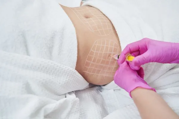 image of fat dissolving injections on love handles to help combat weight gain Newcastle under Lyme
